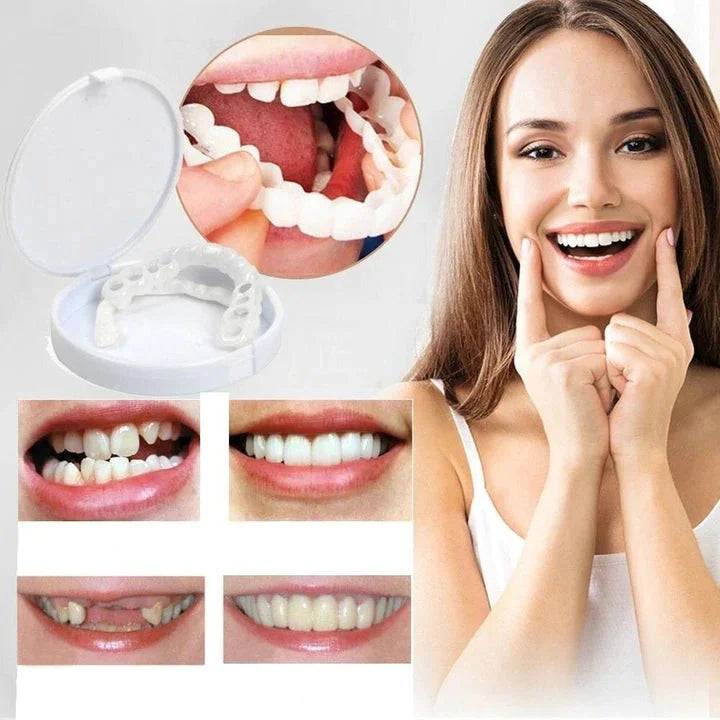 SmileSnap | Instant Veneer Transformation Kit for Aesthetic Tooth Coverage 1